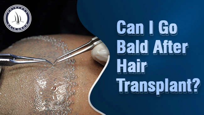 patient going into hair transplant surgery with a concern about bald after hair transplant