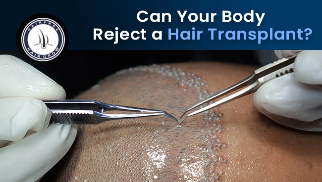 doctor performing hair transplant surgery ensuring body don't reject hair transplant