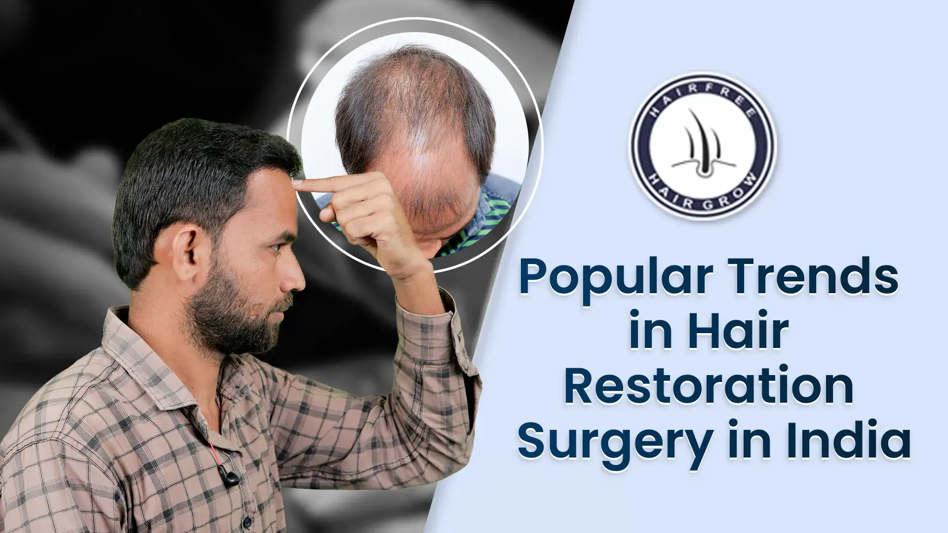 Patient evaluating popular hair transplant trends in India