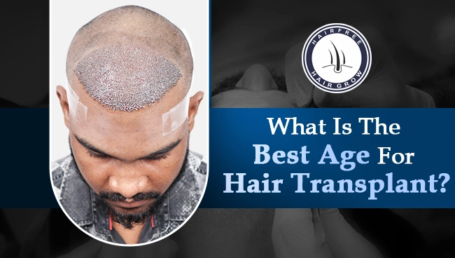 patient of 25 years of age with hereditary balding showing successful hair transplantation to give a perspective on best age for hair transplant