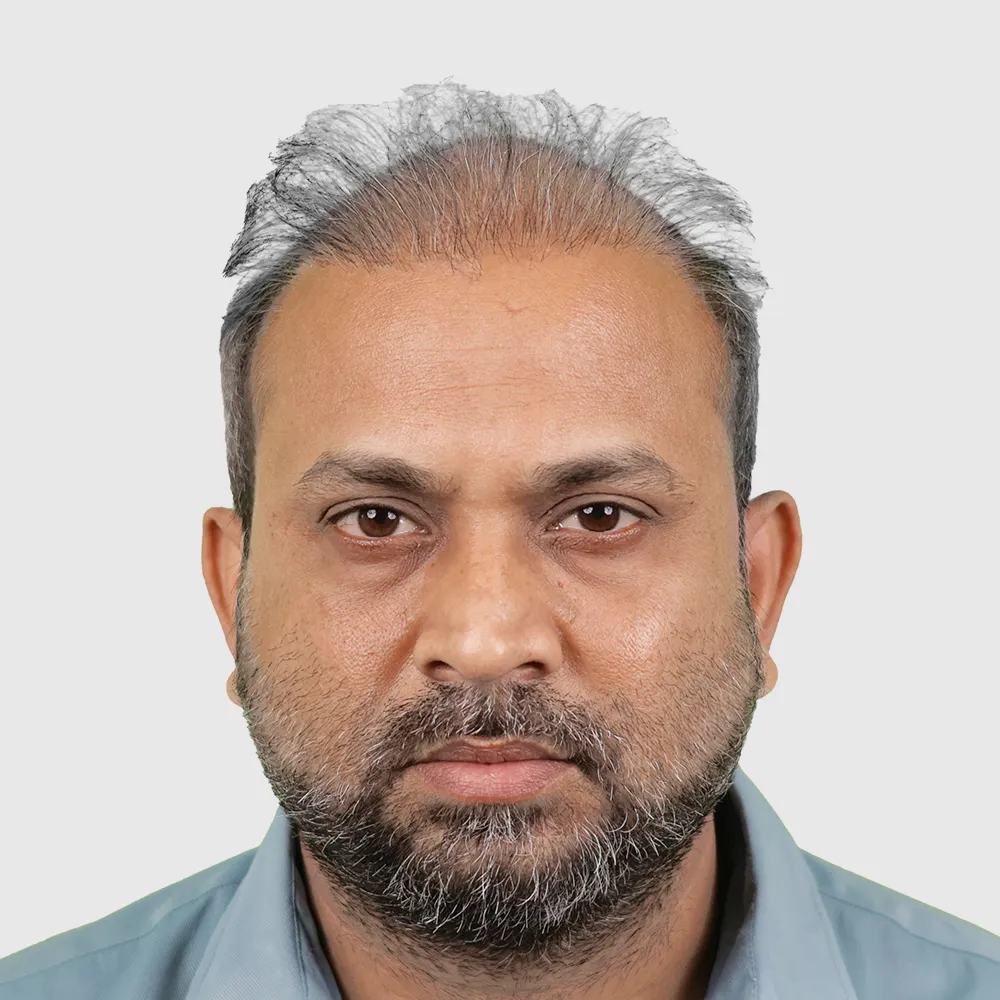 Repair Failed Hair Transplant 